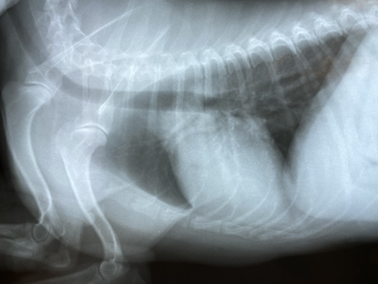 chest xray
